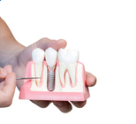 סד כירורגי: הדרך היעילה לביצוע השתלת שיניים-תמונה